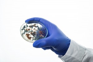 Why Should I Have My Mold Tested?